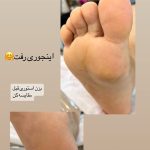 پدیکور و مانیکور