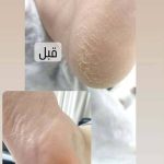 پدیکور و مانیکور