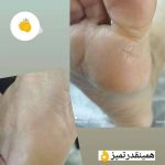 پدیکور و مانیکور