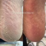 پدیکور و مانیکور