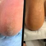 پدیکور و مانیکور