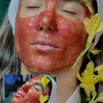 فیشیال صورت سالن زیبایی دهکده بوشهر