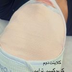 فیشیال صورت
