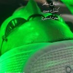 فیشیال صورت