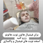 فیشیال صورت