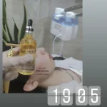 فیشیال صورت