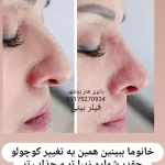 تزریق ژل و فیلر سالن زیبایی بانوی هنر بوشهر
