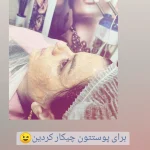 فیشیال صورت