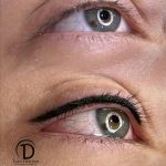 خط چشم و بن مژه دائم