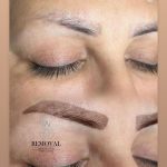 پاک کردن تتو