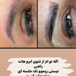 پاک کردن تتو