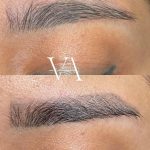 پاک کردن تتو