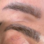 پاک کردن تتو