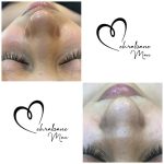 فیشیال صورت