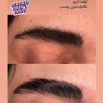 لیفت مژه و ابرو