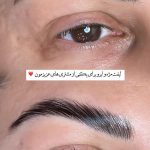 لیفت مژه و ابرو