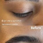 لیفت مژه و ابرو