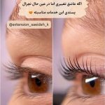 لیفت مژه و ابرو