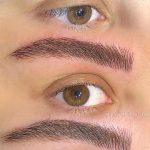 میکروبلیدینگ و فیبروز ابرو