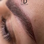 میکروبلیدینگ و فیبروز ابرو