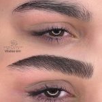 میکروبلیدینگ و فیبروز ابرو