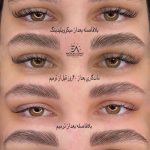 میکروبلیدینگ و فیبروز ابرو