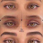 میکروبلیدینگ و فیبروز ابرو