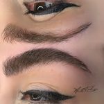 میکروبلیدینگ و فیبروز ابرو