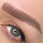 میکروبلیدینگ و فیبروز ابرو