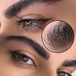 میکروبلیدینگ و فیبروز ابرو