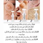 میکرونیدلینگ