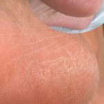 پدیکور و مانیکور