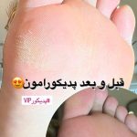 پدیکور و مانیکور