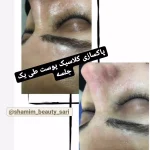 فیشیال صورت