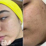 فیشیال صورت