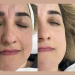 فیشیال صورت