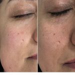 فیشیال صورت