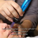 فیشیال صورت