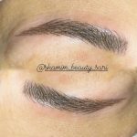 میکروبلیدینگ و فیبروز ابرو