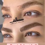 میکروبلیدینگ و فیبروز ابرو