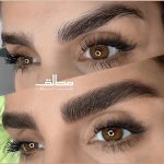 میکروبلیدینگ و فیبروز ابرو