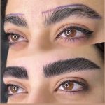 میکروبلیدینگ و فیبروز ابرو