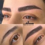 میکروبلیدینگ و فیبروز ابرو