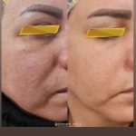 سالن زیبایی ابری تهران