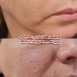 سالن زیبایی ابری تهران