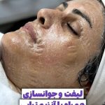 فیشیال صورت