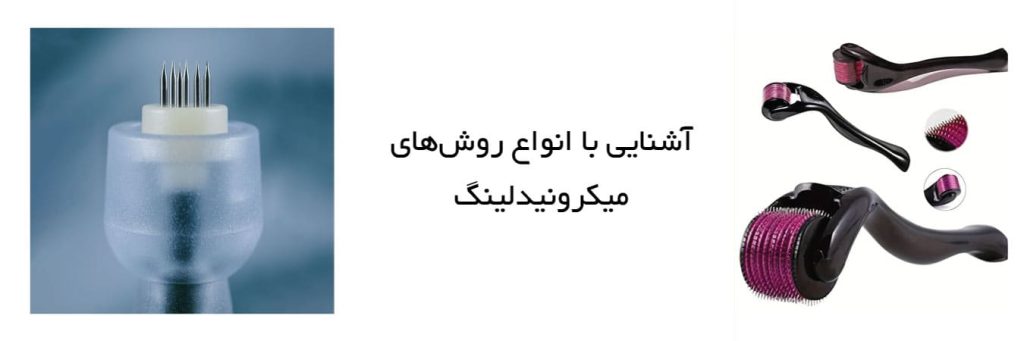 میکرونیدلینگ اصلی