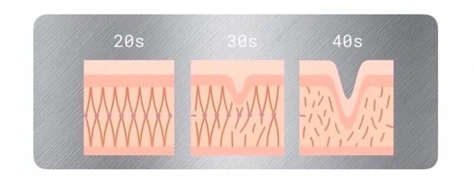 میکرونیدلینگ ۱۱