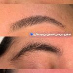اصلاح صورت و ابرو