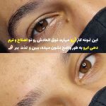 اصلاح صورت و ابرو